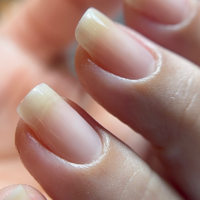 Close de duas unhas naturais, com a região da cutícula limpa e bem definida